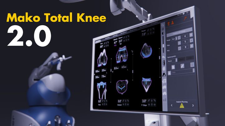 Mako Total Knee 2.0 — Stryker robotic surgery planning interface