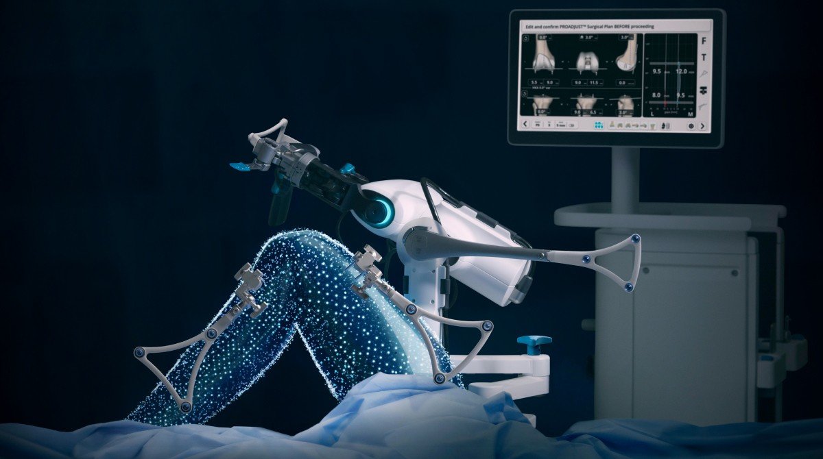 Robotic arm and 3D planning screen used in robotic-assisted knee replacement