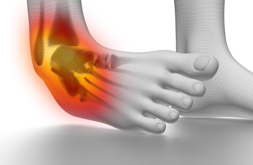 ankle-sprain.jpg
